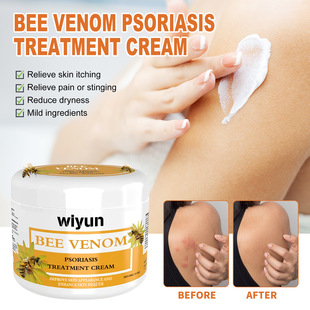 and Red Psoriasis Moss Skin Foot Hand Repair Cream Venom Bee