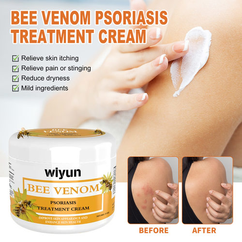 Bee Venom Psoriasis Cream Repair Hand and Foot Skin Moss Red