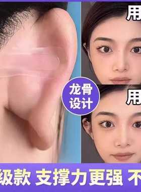 精灵耳支撑器隐形无痛强支撑