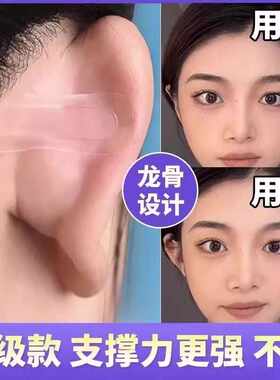 精灵耳支撑器隐形无痛强支撑
