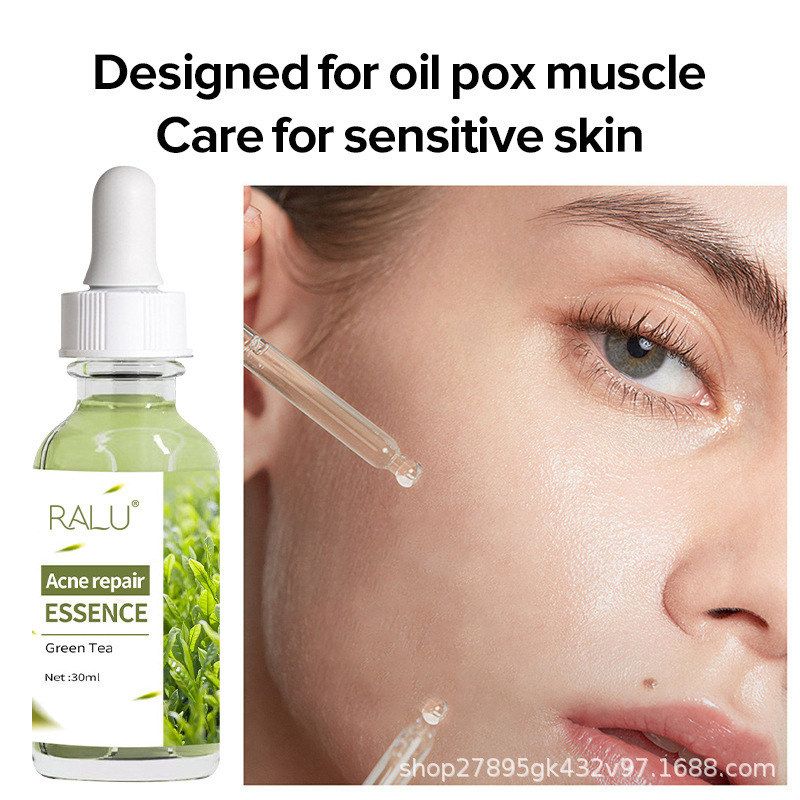 外贸跨境出口RALU草本祛痘水精华液修护肌淡化液态痘印清洁祛痘印