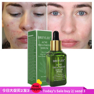 Treatment men Serum Essence women收缩毛孔精华液 Facial Acne