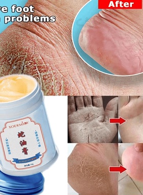 Herbal Anti Crack Foot Cream Heel Crack Repair Exfoliating