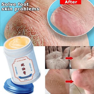 Herbal Anti Crack Foot Cream Heel Crack Repair Exfoliating
