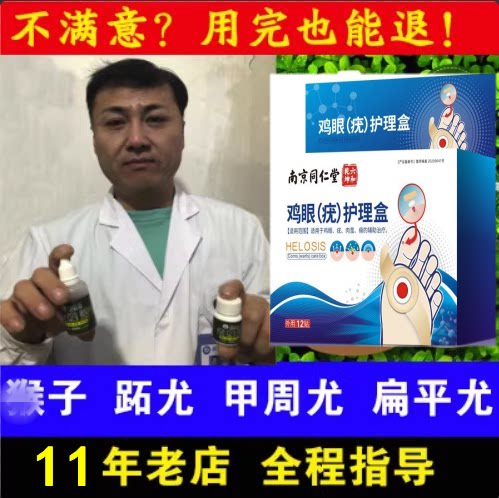 去刺猴正品疙瘩鸡眼老茧肉刺祛尤保健理疗