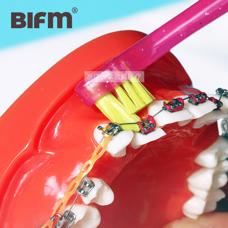 bifm正畸牙刷双头炫彩单束小头软毛U型托槽矫正牙齿专用牙缝清洁