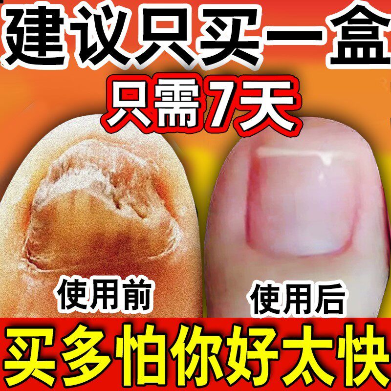 南京同仁堂灰指甲亮甲正品脚趾灰甲液坏甲专用官方官网正品店铺