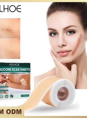 EELHOE 硅胶疤痕贴 妊娠剖腹产手术伤疤肤色隐形美容贴疤痕修护贴