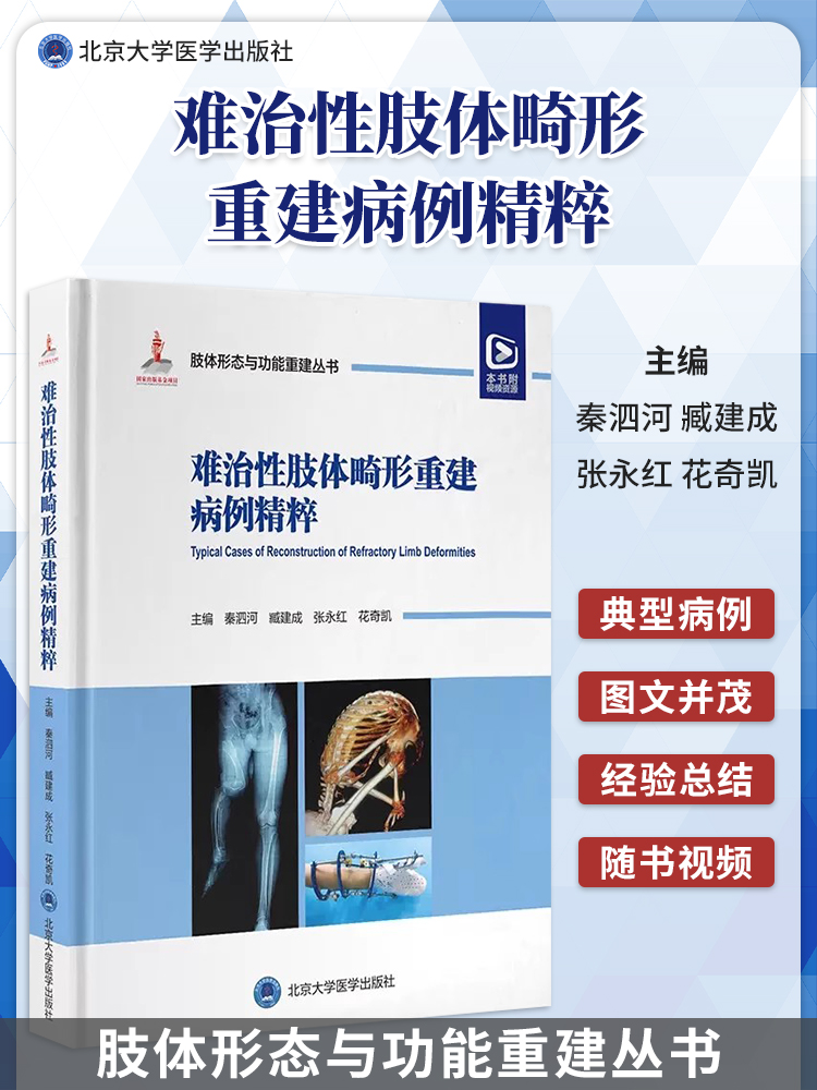 难治性肢体畸形重建病例精粹 肢体形态与功能重建丛书 中国畸形病因病种分类上肢下肢形态与功能重建小儿肢体矫形器 9787565929595