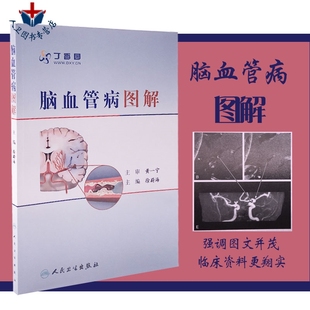 徐蔚海 脑血管病图解 丁香园医学参考书籍 脑血管治疗学医学工具书籍 社9787117140041 人民卫生出版 包邮