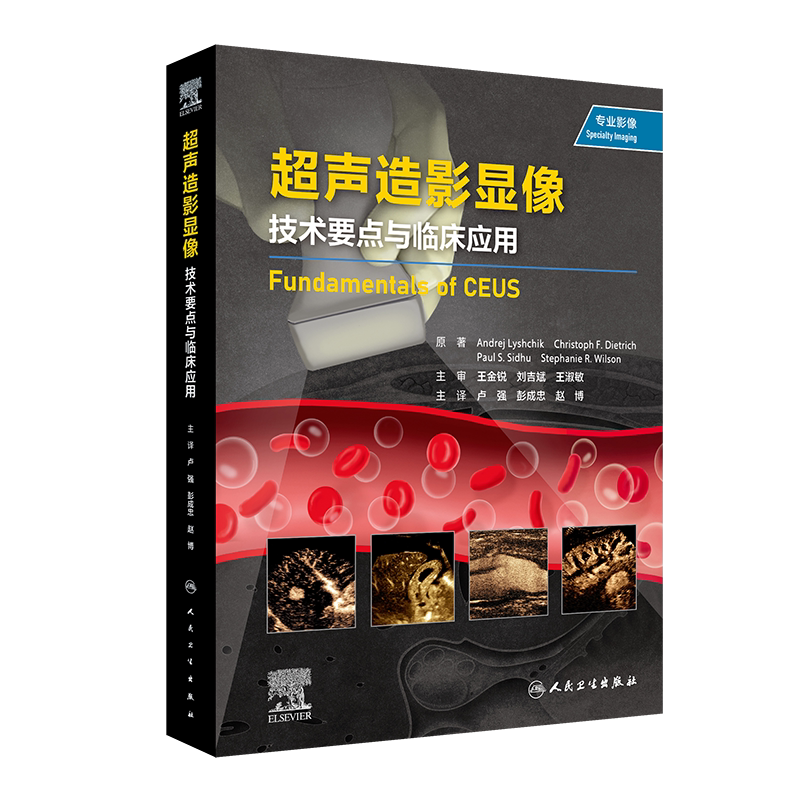 超声造影显像技术要点与临床应用