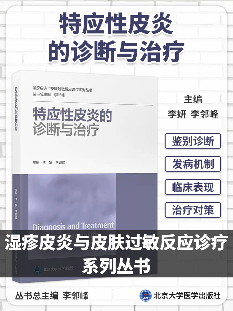特应性皮炎的诊断与治疗 李妍 李邻峰 湿疹皮炎与皮肤过敏反应诊疗系列丛书 皮肤科医生指导书 北京大学医学出版社9787565927577