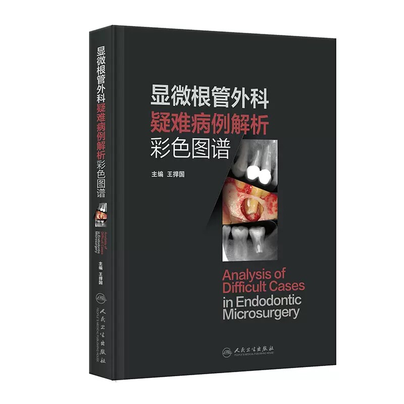 显微根管外科疑难病例彩色图谱