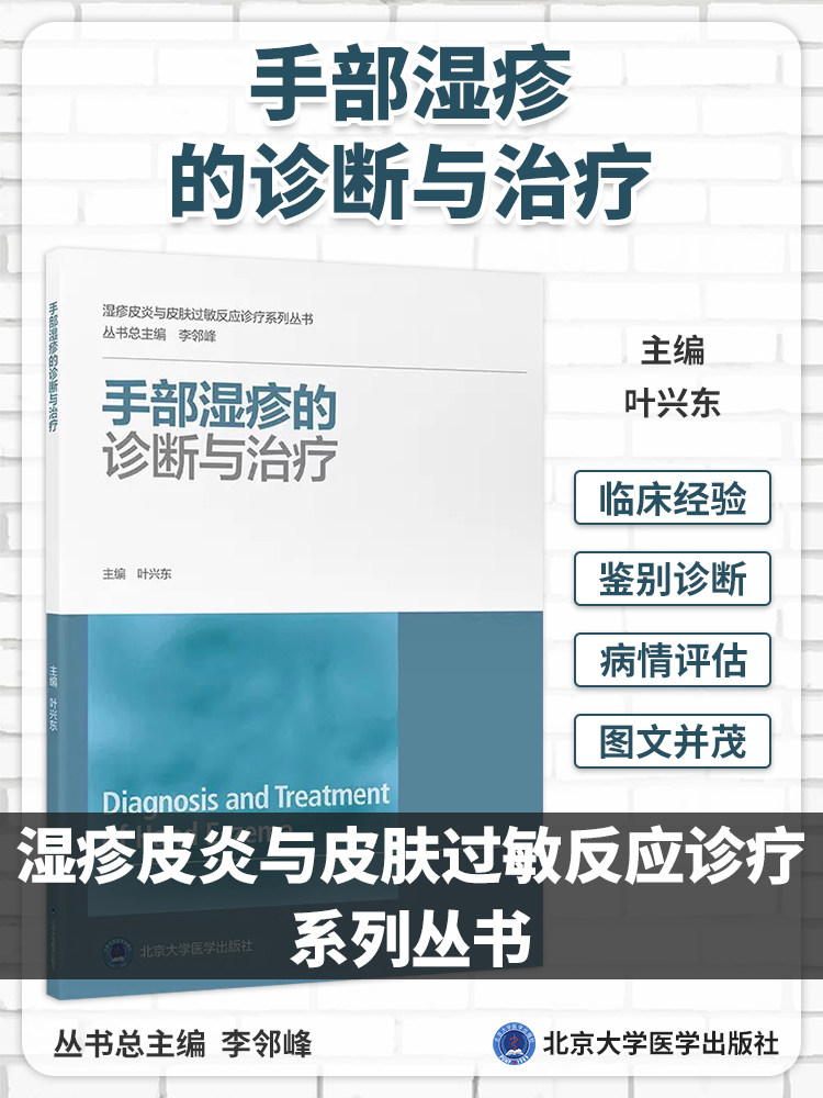 手部湿疹的诊断与治疗 叶兴东 湿疹皮炎与皮肤过敏反应诊疗系列丛书