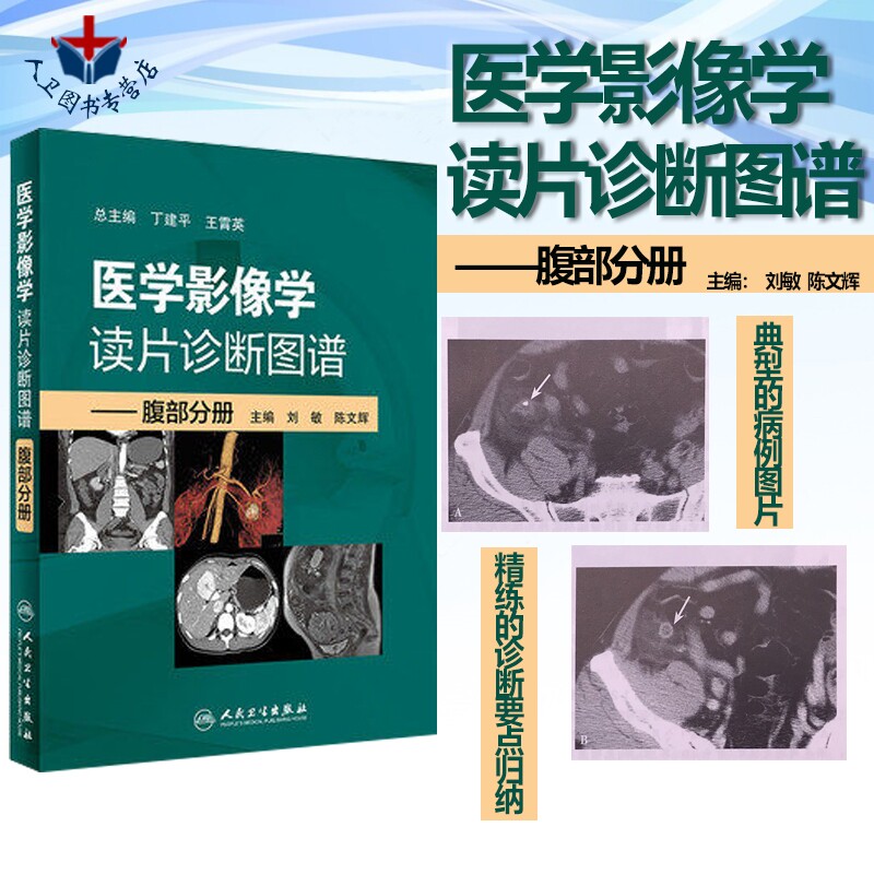 人卫正版 医学影像学读片诊断图谱 腹部分册 刘敏 陈文辉  影像医学  人民卫生出版社9787117269681