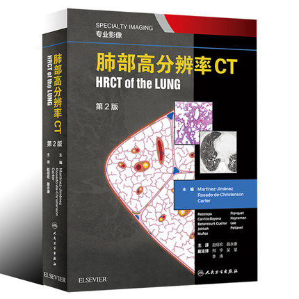 人卫肺部高分辨率CT放射医学影像