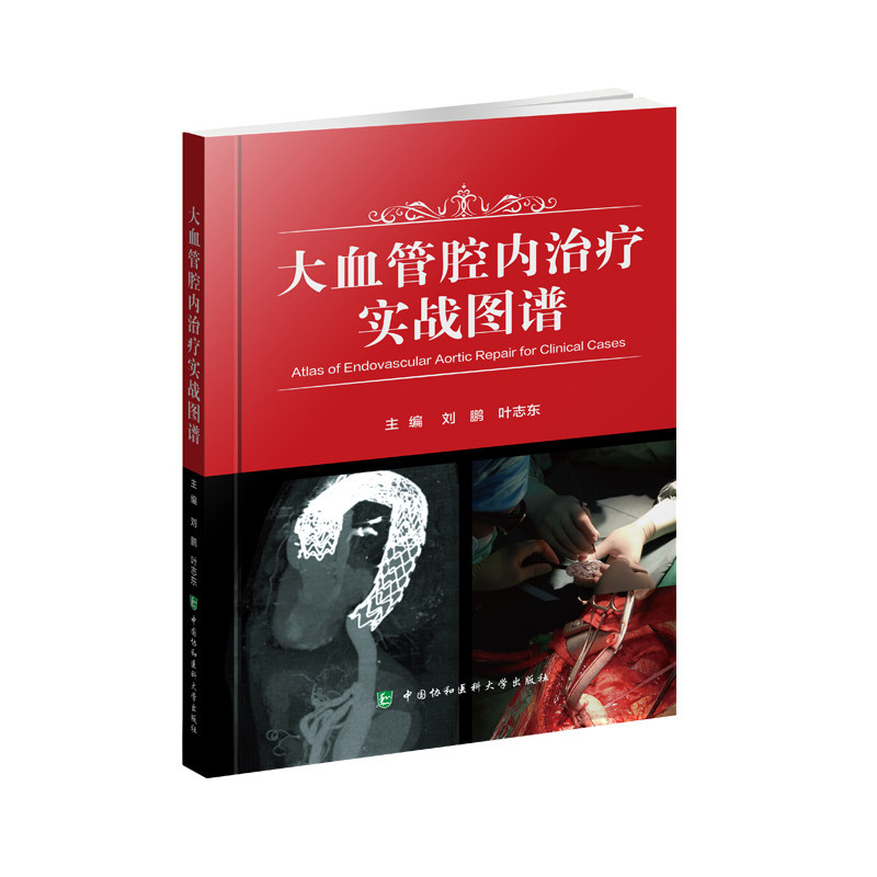 大血管腔内治疗实战图谱 刘鹏 叶志东 主编 9787567917521 中国协和医科大学出版社