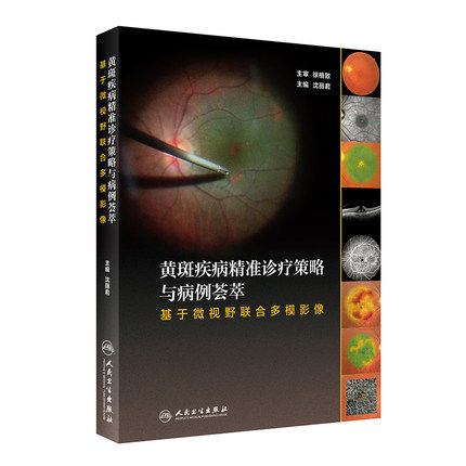 黄斑疾病精准诊疗策略病例荟萃