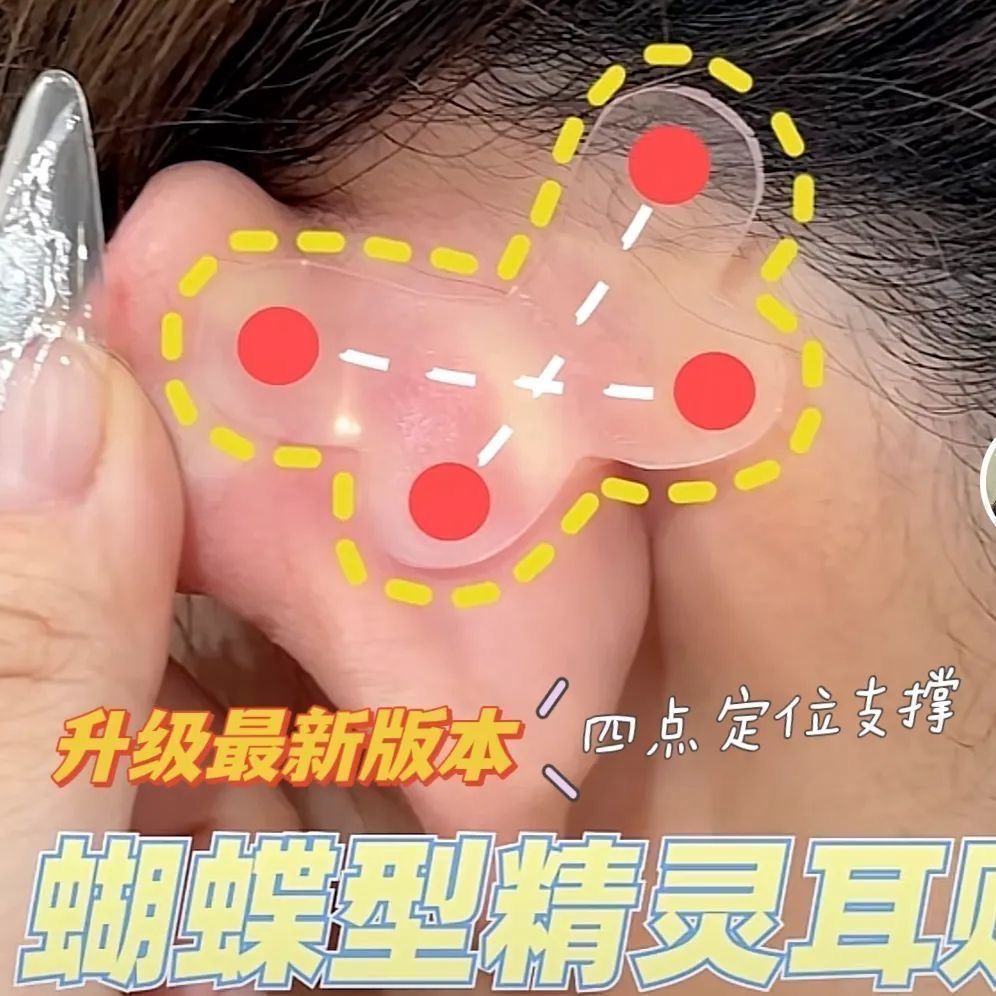 精灵耳贴蝴蝶定型耳立神器防水汗耳朵支撑隐形器大脸显小防汗