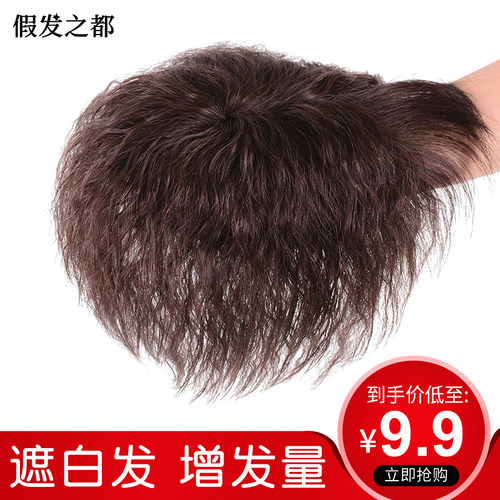 假发片头顶补发女遮白发