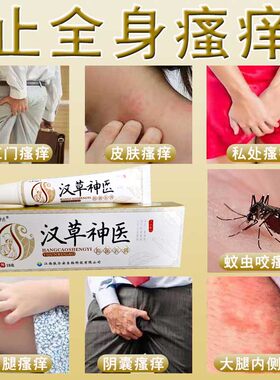 汉草神医热痱子蚊虫叮咬止痒膏