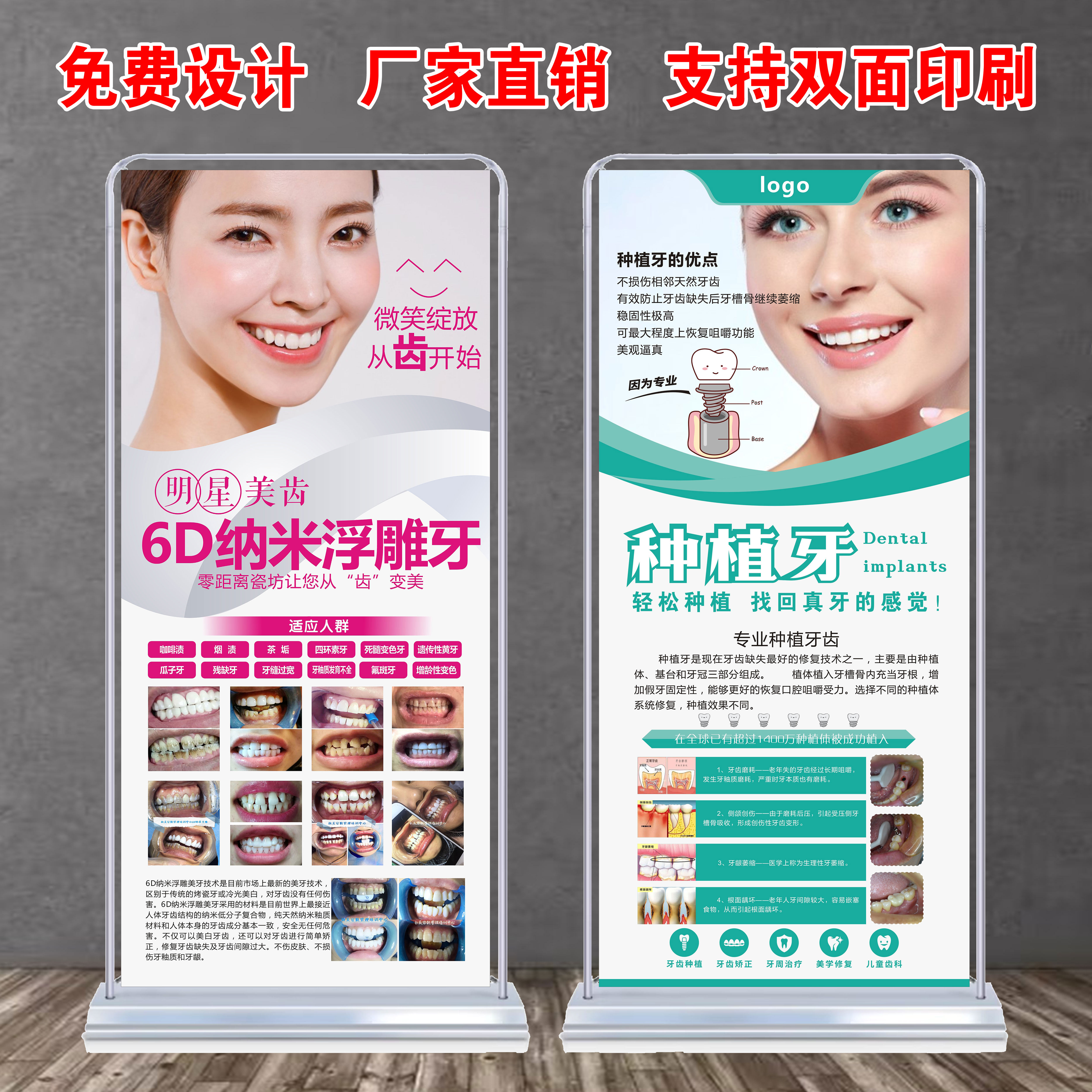 种植牙纳米浮雕牙修复广告宣传海报定制易拉宝挂画x注水门型展架