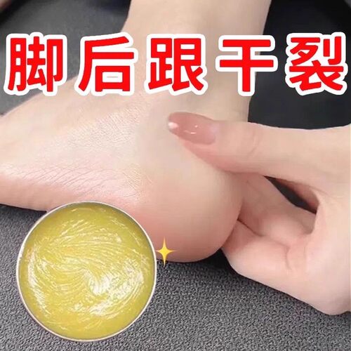 手足脚后跟干裂足霜补水护手