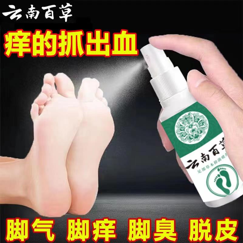 官方正品足部脚臭脚气脚痒水泡脱皮脚汗糜烂止痒脚丫抑菌喷雾剂