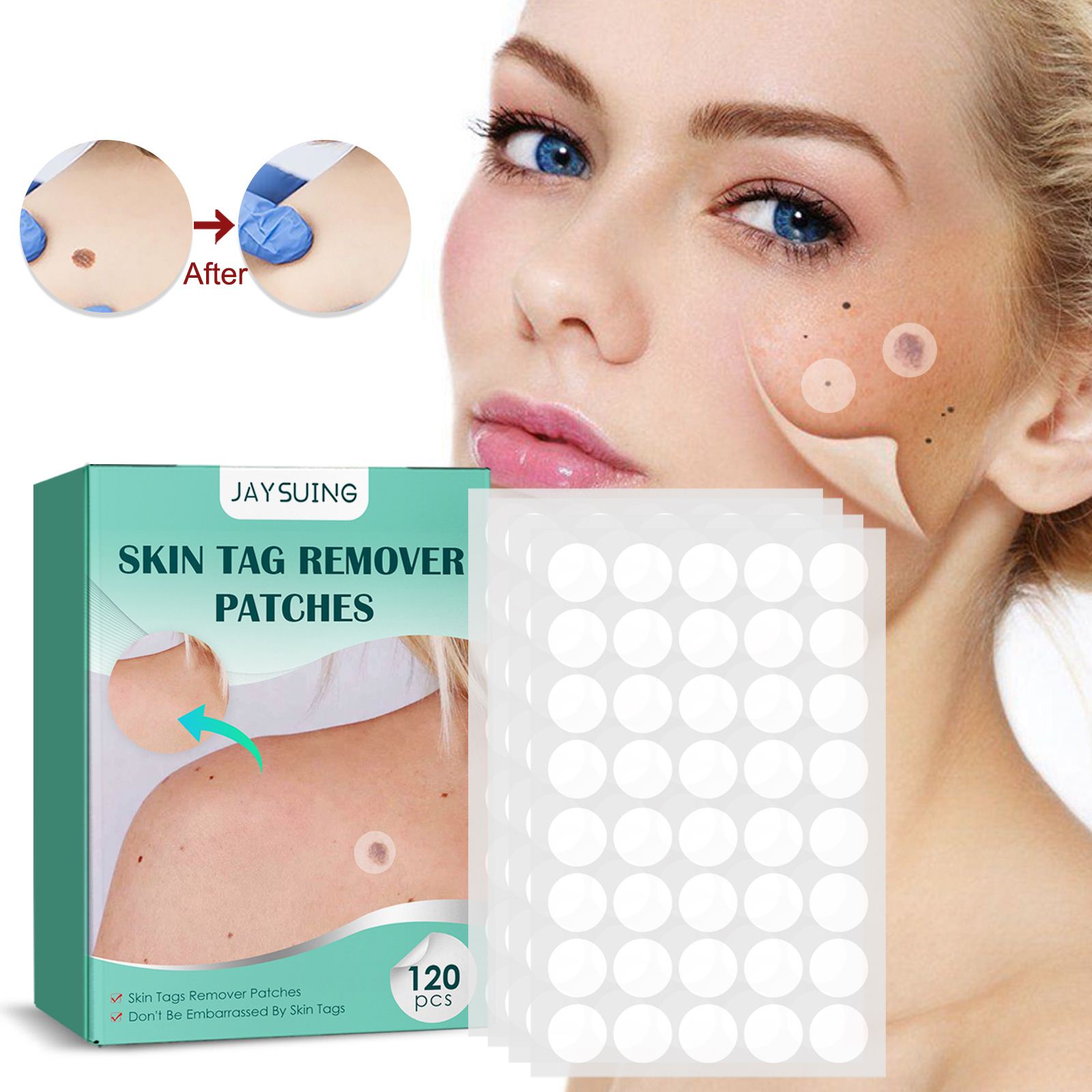 wart patch Dot mole wart wart wart callus meat flat filament