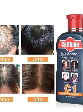 Caffeine Shampoo Slow Down Hair Loss Stimulate Hair Growth