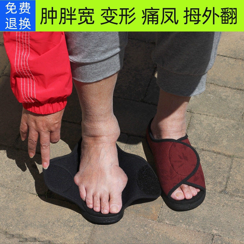 春夏老人脚肿拇指外翻脚背高大骨糖足术后痛凤变形加宽调节布拖鞋