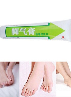 Skin Itching Antifungal Cream For Corticosteroid Body Tinea