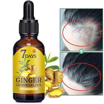 Hair Loss Treatment Ginger Growth Essence Oil老姜头发养护油