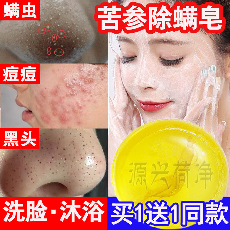 苦渗生除螨养肤皂除脸上螨虫皂神器除螨皂祛痘洗脸部身体全身痘痘