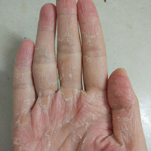 老板娘力推好物【一抹不痒】用过的都说好 买二送一 活动中