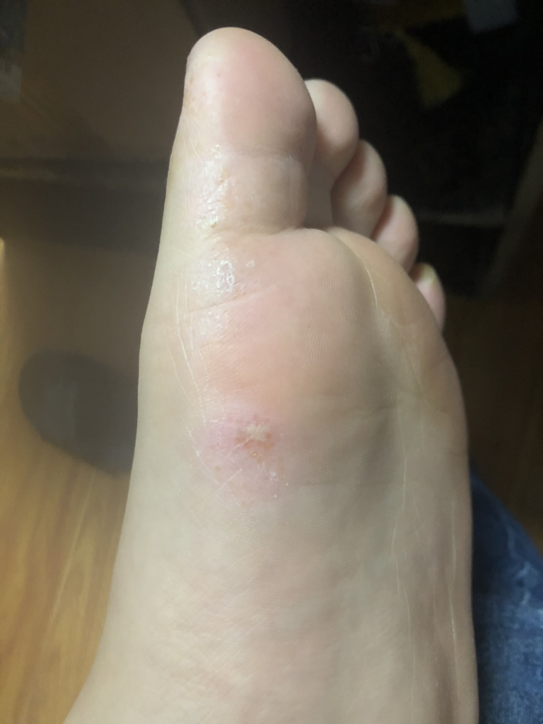 老卢头陆大中国裂烂滋和