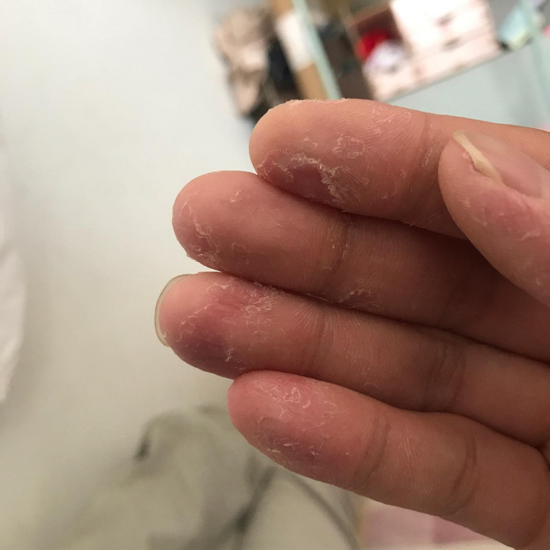 抖音同款手气手脱皮膏水泡手掌开裂干裂手蜕皮修复霜手上起皮爆皮