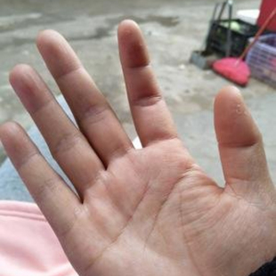 手痒脱皮水泥过敏痒干裂起小水泡止痒膏干燥季节性全身建筑专用