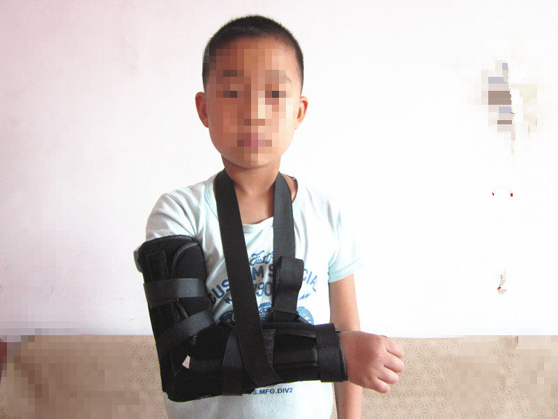 儿童肘关节固定支具护具手臂上肢骨折替石膏透气带钢板肱骨髁上