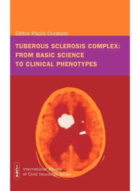 按需印刷Tuberous sclerosis complex[9781898683391]