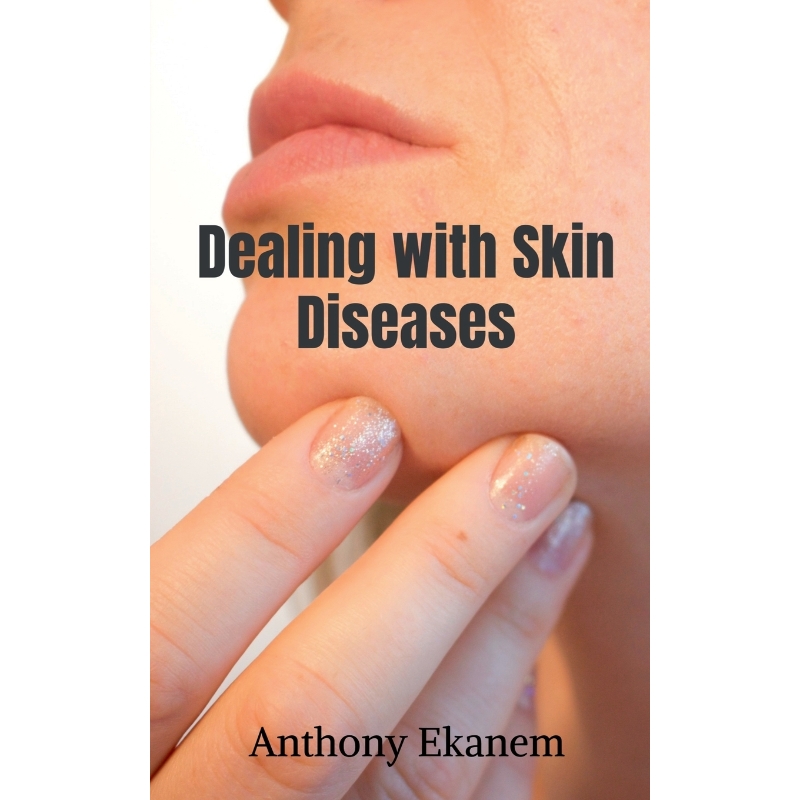 按需印刷Dealing with Skin Diseases[9781639977352]