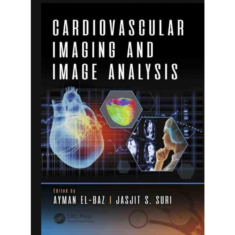 按需印刷不退不换Cardiovascular Imaging and Image Analysis[9781498797580]