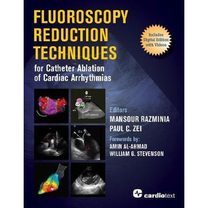 预订，预计下单后2-3周左右发货！