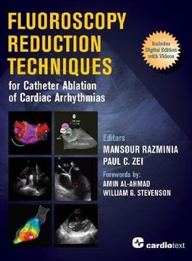 按需印刷Fluoroscopy Reduction Techniques for Catheter Ablation of Cardiac Arrhythmias[9781942909309]
