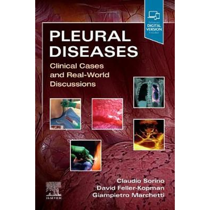 预订Pleural Diseases:Clinical Cases and Real-World Discussions