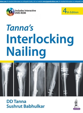 按需印刷Tanna'S Interlocking Nailing With Dvd-Rom[9789352500604]