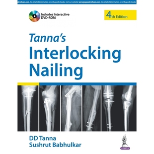 按需印刷Tanna'S Interlocking Nailing With Dvd-Rom[9789352500604]