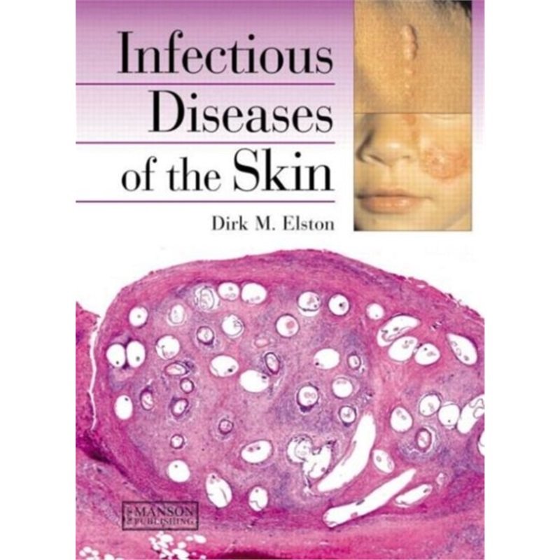 预订不退不换Infectious Diseases of the Skin[9781840761078]