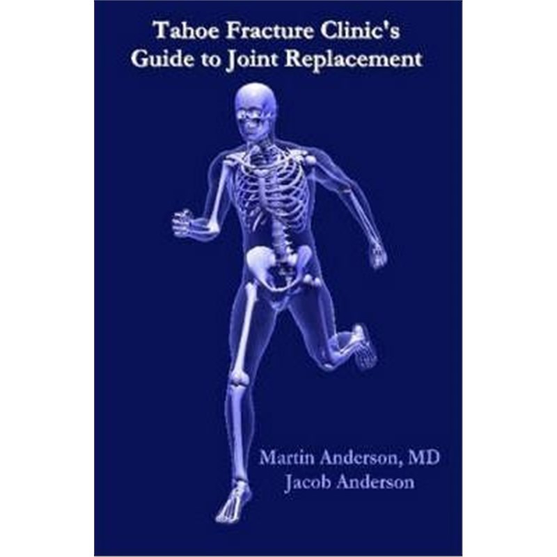 预订，预计下单后3-4周左右发货！