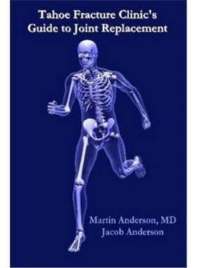 按需印刷Tahoe Fracture Clinic's Guide to Joint Replacement[9781430316732]